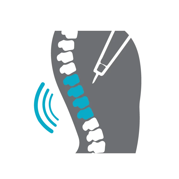 Spine-Surgery Back and Spin Skeleton - Icon